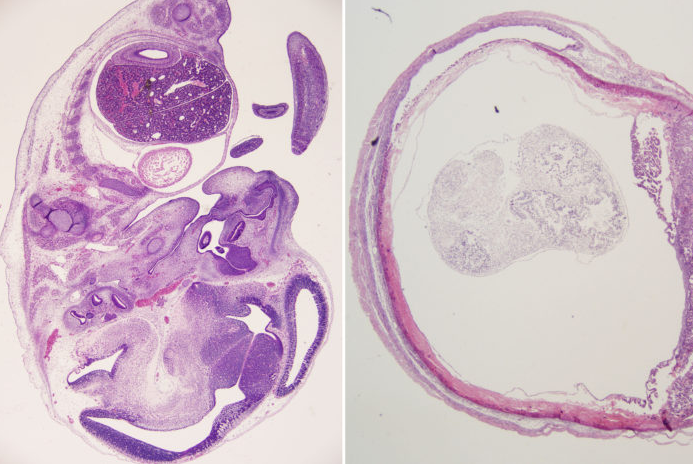 Antibody protects against both Zika and dengue, mouse study shows