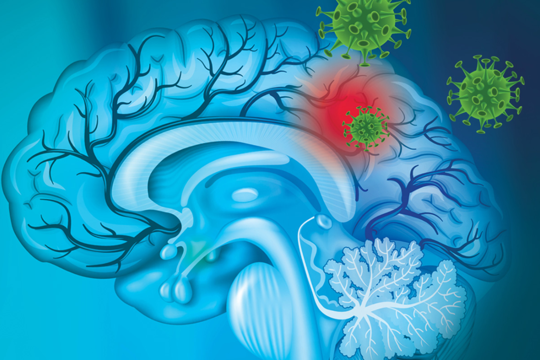 Cancer Weapon: Zika virus kills glioblastoma stem cells in early research