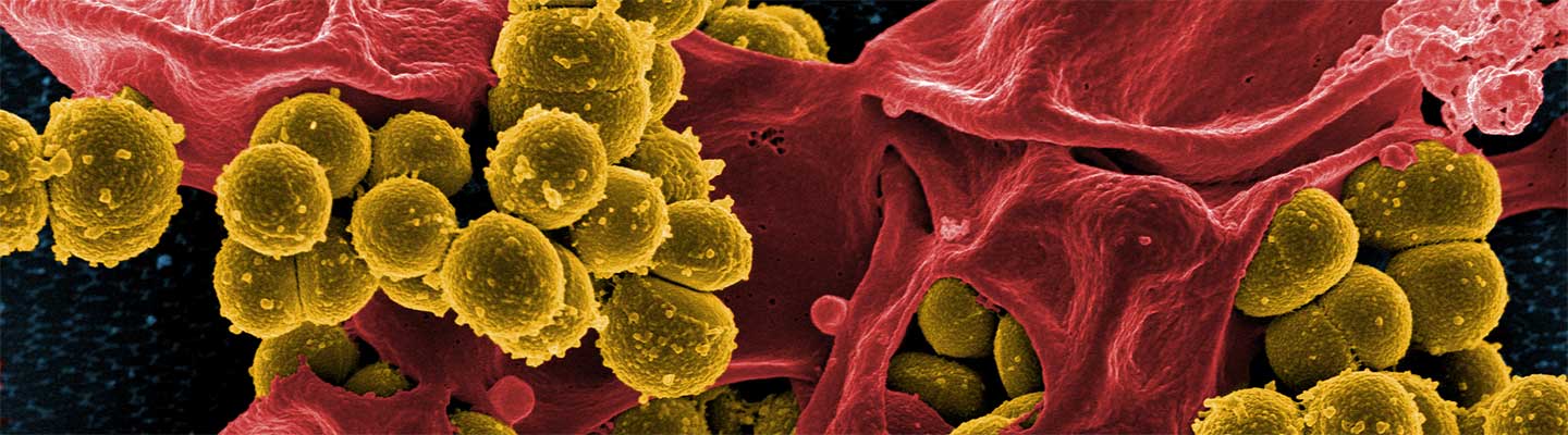 Infectious Diseases Fellowship Program at Washington University