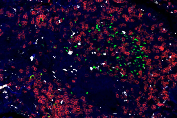 Immune responses to tuberculosis mapped across 3 species