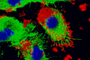 Macrophage with nanoparticles