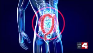 Channel 4 News Graphic