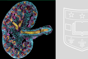 Mahjoub Lab image from JCI Insight