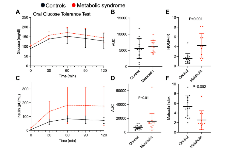 Decreased sarcoplasmic reticulum phospholipids in human skeletal muscle are associated with metabolic syndrome