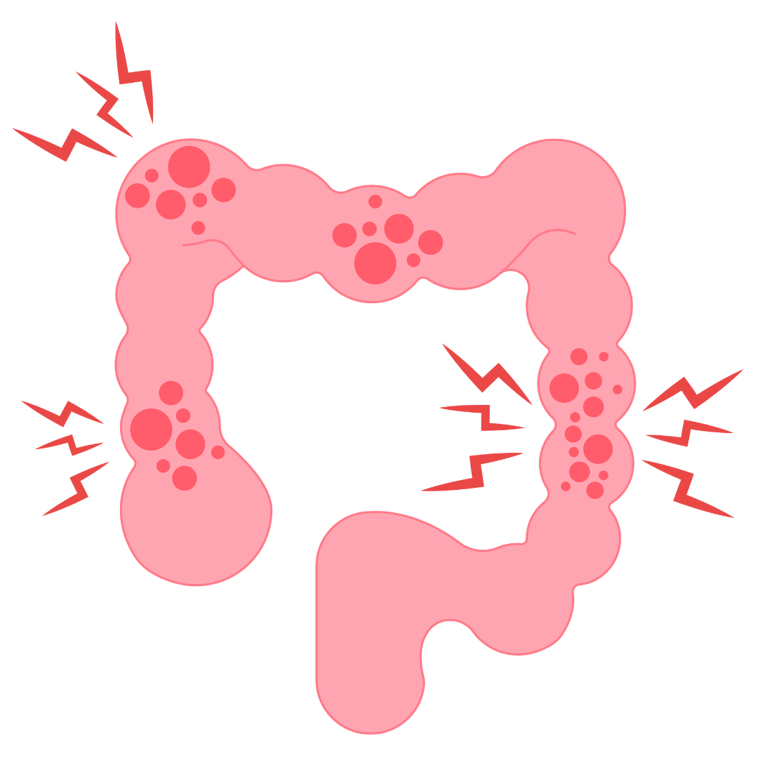 April marks Irritable Bowel Syndrome (IBS) Awareness Month - John T ...