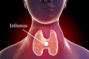 Cytologic and molecular assessment of isthmus thyroid nodules and carcinomas