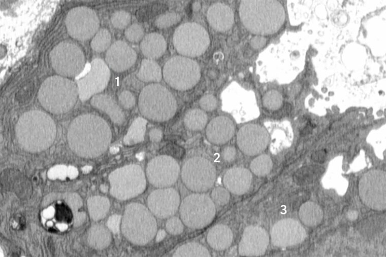 A new study from WashU Medicine identifies a previously unknown way that cells purge waste in a process that helps them revert to a stem cell-like state to promote healing after injury. Here, three mouse stomach cells (numbered) are shown jettisoning cellular debris through cavities (white) that form in their membranes. The researchers dubbed the new purging process “cathartocytosis,” combining Greek root words meaning cellular cleansing. (Image: Jeffrey Brown/WashU Medicine)