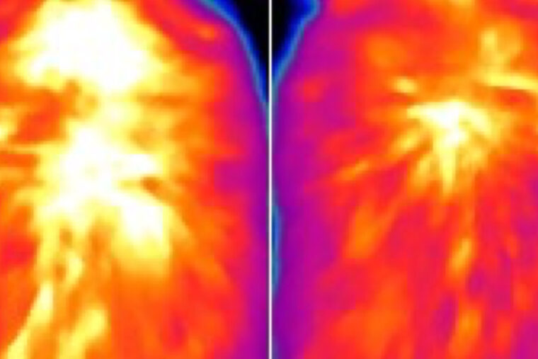 A new study led by researchers at WashU Medicine reveals possible new avenues to exploit brown fat to treat metabolic diseases such as obesity. Infrared images indicate reduced levels of heat production from brown fat in a mouse lacking a protein called ACOX2 (right), compared to a control mouse. Restoring high levels of ACOX2 in brown fat led to increased heat production and better weight control even in mice on a high-fat diet. (Image: Weisensee lab/WashU)