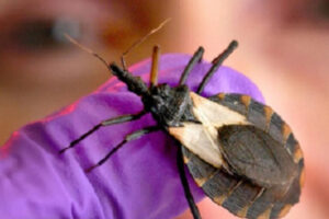 kissing bug disease