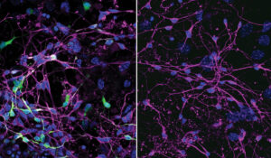 Researchers at WashU Medicine have identified key entry routes that two deadly viruses use to infect cells. Shown are mouse neurons and their cell nuclei (purple and blue). On the left, infection with tick-borne encephalitis virus is visible in green. On the right, mouse neurons missing a key entry receptor are protected from infection, showing no green. Strategies that disrupt these entry routes could help guide development of new ways to prevent or treat these viral infections. (Image: Pengfei Li, Hana Janova/WashU Medicine)