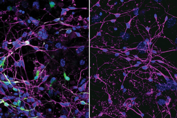 Discovery of viral entry routes into cells points to future prevention, treatment strategies