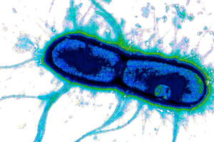 WashU Medicine researchers and collaborators at the University of Missouri identified a shared vulnerability across diarrhea-causing bacteria including E. coli (shown) and Shigella, a finding that could potentially lead to a single combination vaccine against these pathogens.