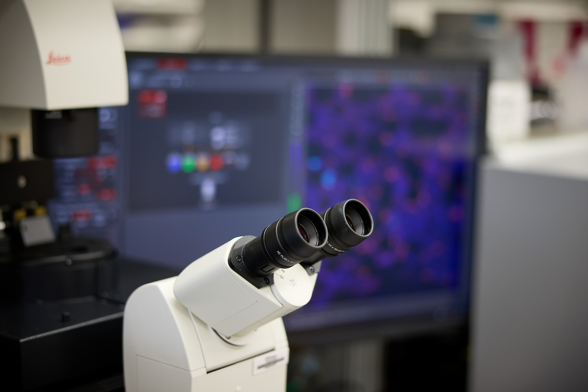 Research Fellowship in Neurodegeneration and Neuroinflammation
