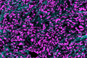$11.7 million from NIH supports research on inflammation in blood cancers
