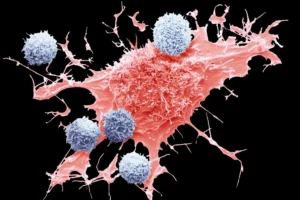 A composite colored scanning electron micrograph of T cells, blue, and a lymphoma cancer cell, red.Credit...Steve Gschmeissner/Science Source