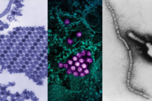 WashU Medicine scientists lead two large, multicenter programs to develop vaccines and antibody-based therapies for understudied viruses with pandemic potential, including the three shown above: (left to right) chikungunya, dengue and parainfluenza viruses. The programs are supported by two grants from the National Institute for Allergy and Infectious Diseases (NIAID) totaling more than $30 million a year for three years.