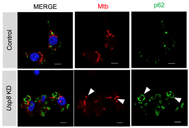 Immunofluorescence images show red fluorescent Mtb and selective autophagy marker, p62, (in green) in control and USP8-depleted mouse macrophages. Arrow heads mark bacteria that colocalize with p62.  